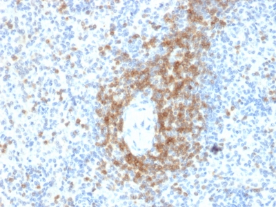FFPE human spleen sections stained with 100 ul anti-CD3 (clone C3e/2478) at 1:200. HIER epitope retrieval prior to staining was performed in 10mM Citrate, pH 6.0.